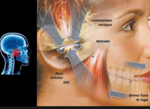 Clinica Dental Dra Maria Teresa P Rez Pizarro Que Es El Atm